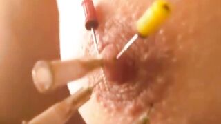 Needles in nipple