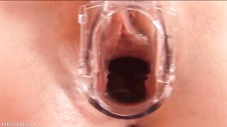 Teenager-Vagina mit Spekulum untersucht