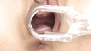 Orgasmo masivo con espéculo