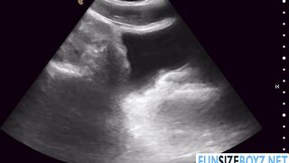 Lors de l'échographie, mon médecin me pénètre.