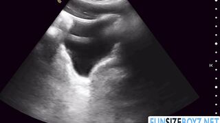 Lors de l'échographie, mon médecin me pénètre.